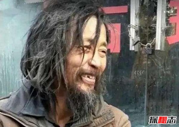 霍金为什么被誉为宇宙之王？世界伟人霍金名副其实