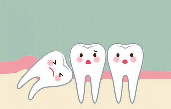 拔智齿后悔死了?这几种情况拔智齿会后悔(千万注意)