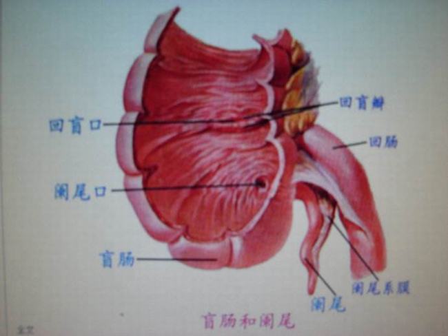 阑尾一定要割掉吗?阑尾切除的坏处