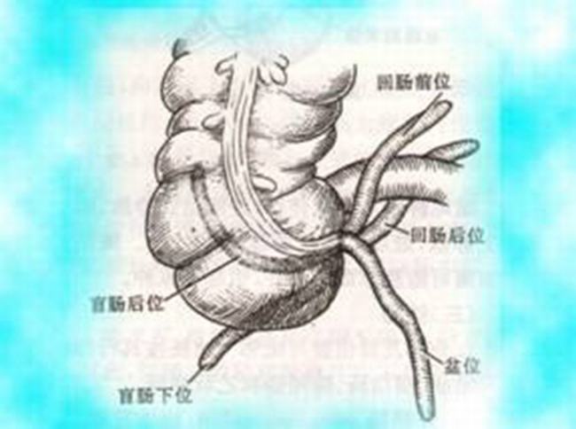 阑尾一定要割掉吗?阑尾切除的坏处