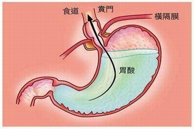 胃液为什么是酸性的?维持肠胃无菌环境(激活蛋白酶)