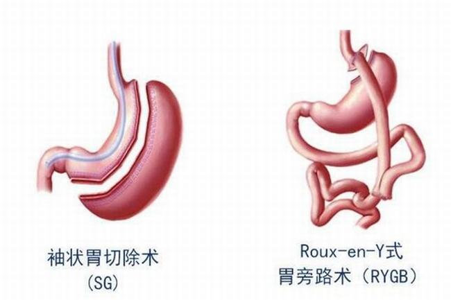 胃液为什么是酸性的?维持肠胃无菌环境(激活蛋白酶)