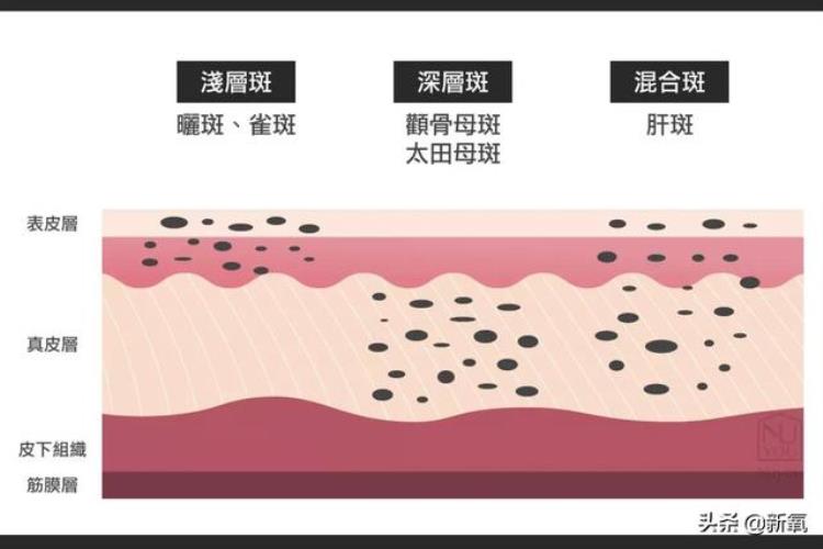 奶酷少年脸成高奢新宠模特多亏了她满脸的雀斑