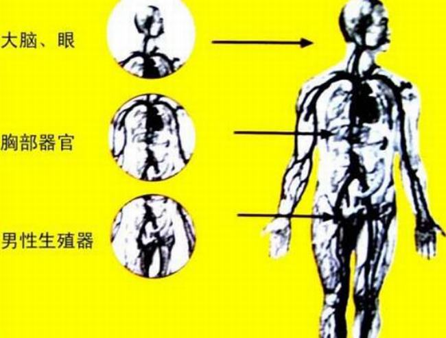 辐射病是什么病?有哪些症状证明被辐射了