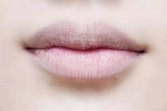 秋季嘴唇干起皮怎么办？这些办法可以让嘴唇恢复滋润