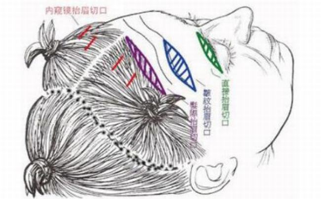 捂黄豆要不要趁热捂 冷热皆可（对于成功与否影响不大）