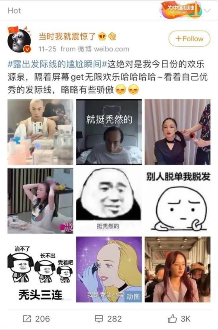 美人发际线是什么意思,如何不露出发际线