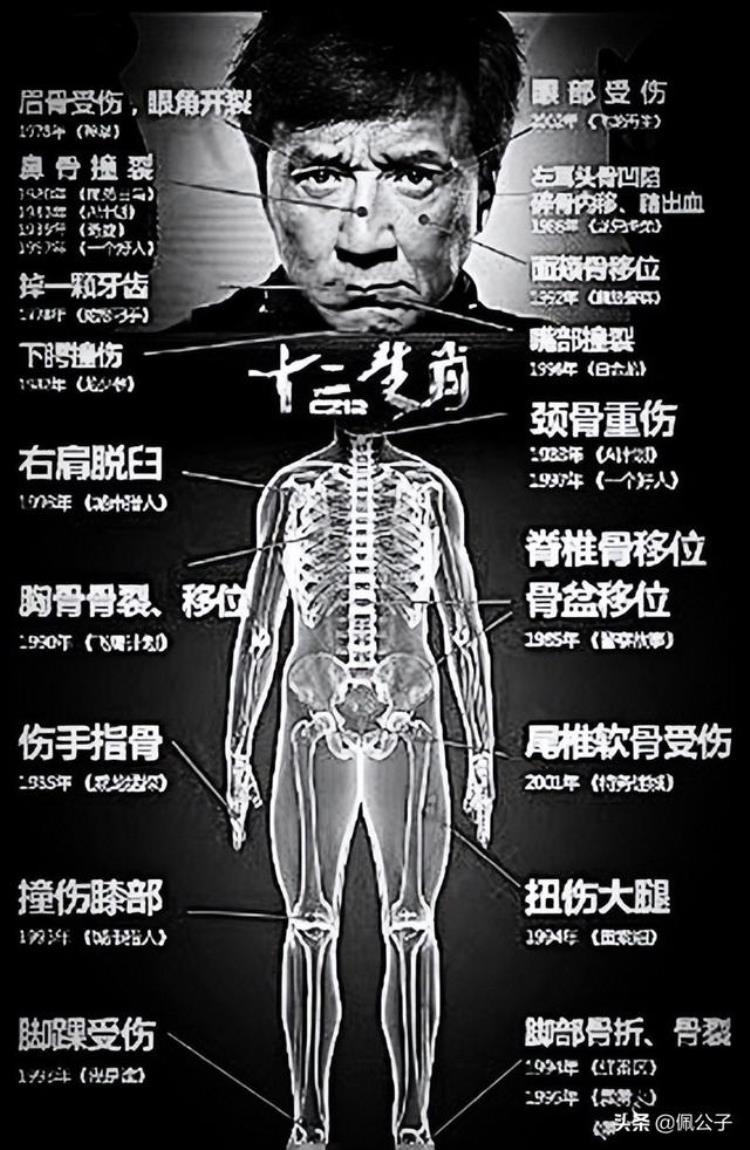 成龙高空滑楼,成龙演戏时摔得最惨的一次