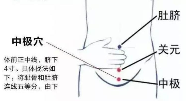 中极:保证健康与子嗣繁衍的腹地