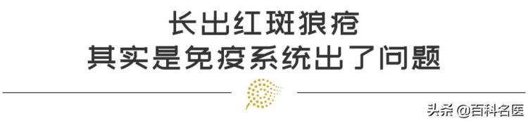 长出红斑狼疮原来是免疫系统出了问题