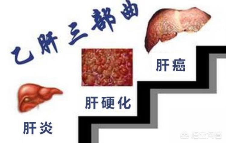 除了新冠这4种病毒也要警惕它们可能会引发多种癌症,新冠病毒可以引起恶性肿瘤吗