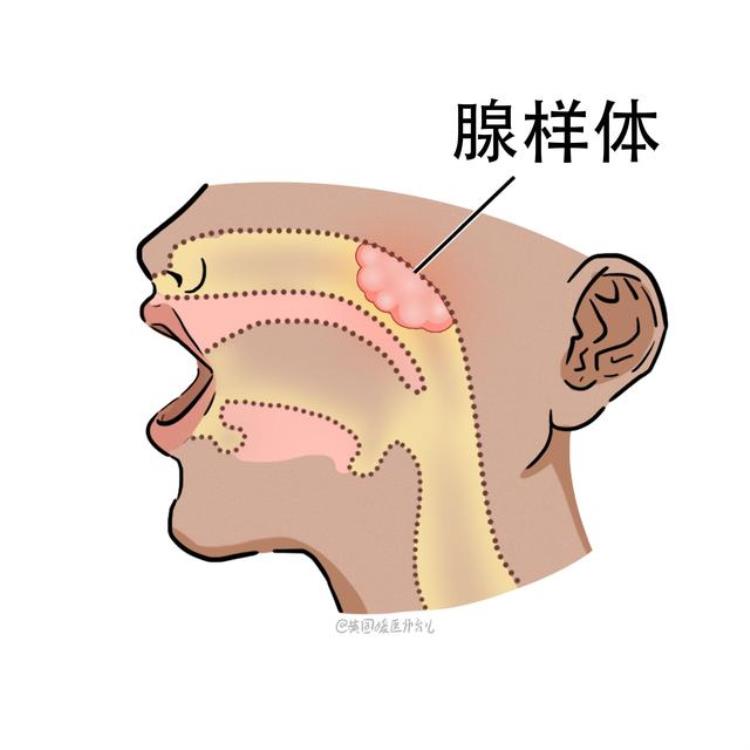 病毒性感冒吃抗生素没用,抗生素对细菌有用还是对病毒有用