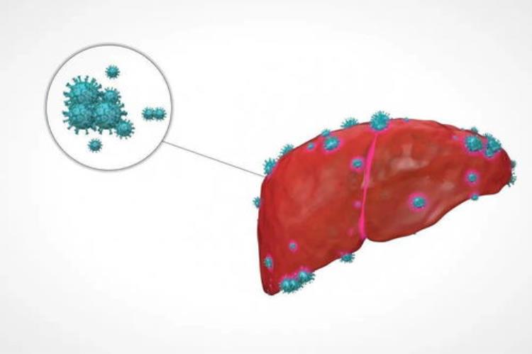 乙肝病毒是如何在体内形成感染的呢「乙肝病毒是如何在体内形成感染的」