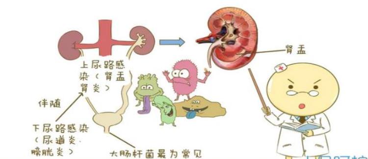 怀疑泌尿系感染应该做哪些检查呢,怀疑肾炎做什么检查