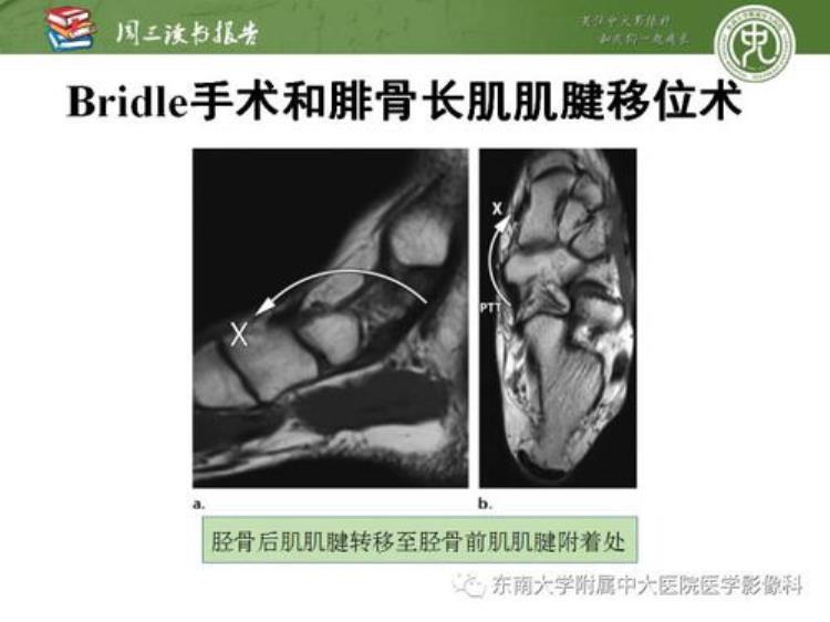 康康姐的闺密没想到做了一次CT的后果这么严重